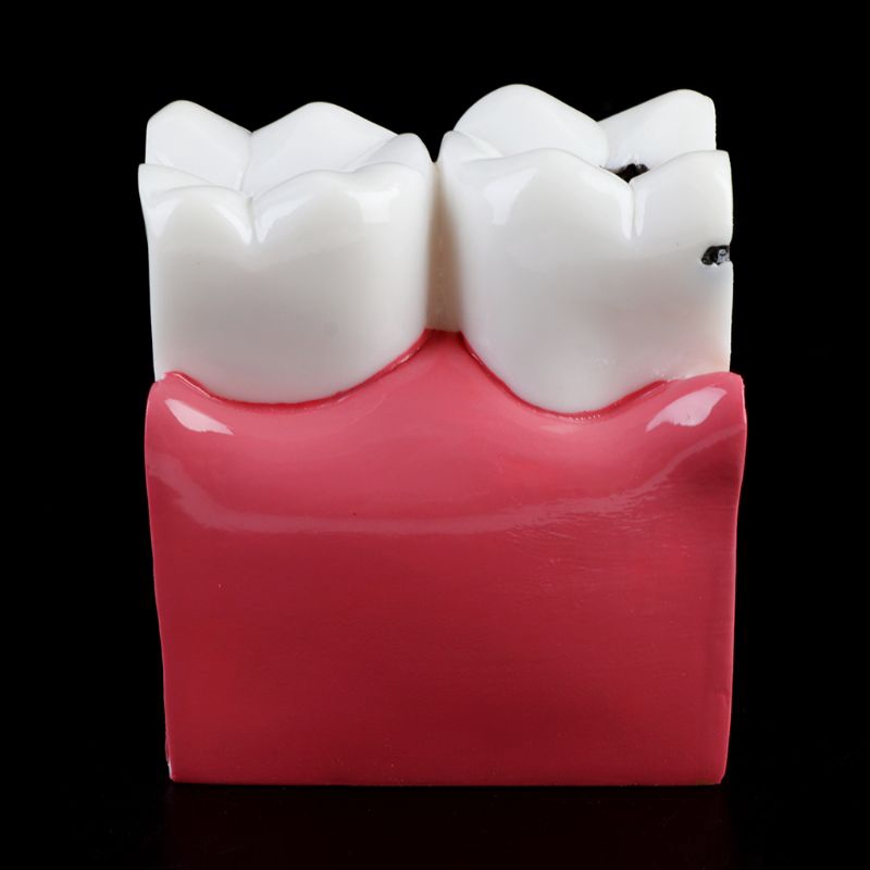Mô hình răng giải phẫu dùng trong giảng dạy tiện dụng