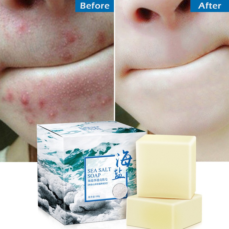 【In Stock】 100g Sea Salt Soap Cleaner Removal Pimple Pores Acne Treatment Goat Milk Moisturizing Face Wash Soap Base Skin Care 【OK】