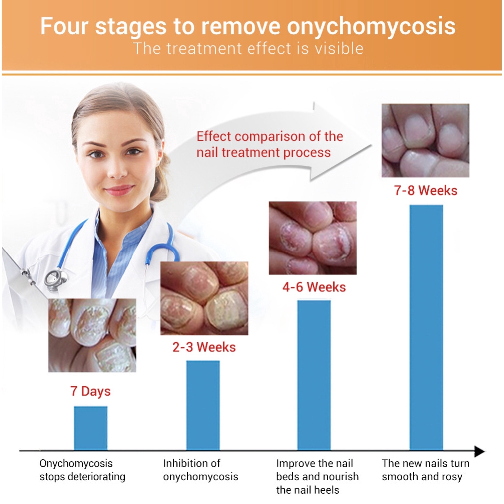 Tinh Chất Phục Hồi Móng Tay / Chân Lanbena Chiết Xuất Hoa Hướng Dương | BigBuy360 - bigbuy360.vn