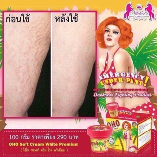 Kem trị rạn da- xách tay thái lan
