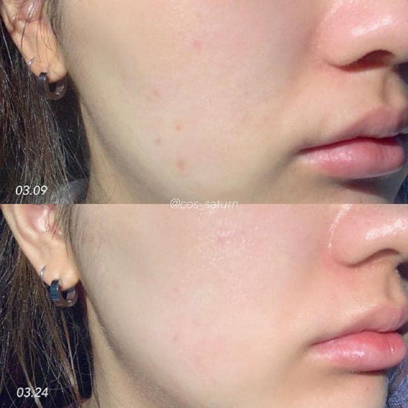 Mặt Nạ Dưỡng Da Cân Bằng pH 5.5 Red Ampoule Mask 30ml