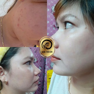 Combo Hoàng Thiên Sâm ⚡ Freeship⚡ (Bột rữa mặt và tinh chất Hoàng Thiên Sâm)