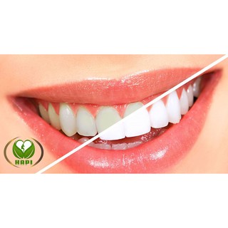 BỘT TRẮNG RĂNG T-WHITE, CÓ TEM BẢO HÀNH CÔNG TY, ĐƯỢC KIỂM TRA HÀNG TRƯỚC KHI NHẬN