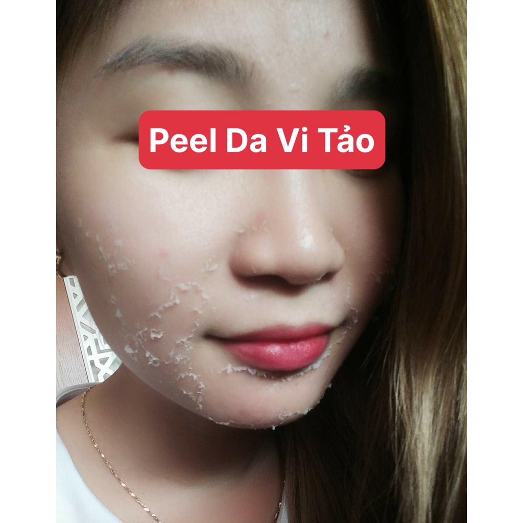 Peel da mặt vi tảo biển BTox - tẩy da chết thay da sinh học cho mặt - Pell lột da mặt - tái tạo da mờ thâm nám