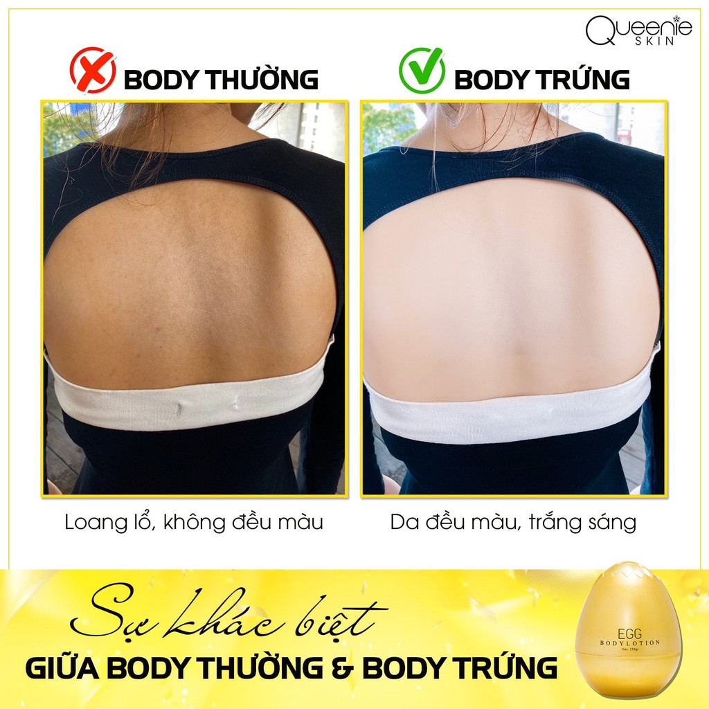 BODY TRỨNG VÀNG | BigBuy360 - bigbuy360.vn