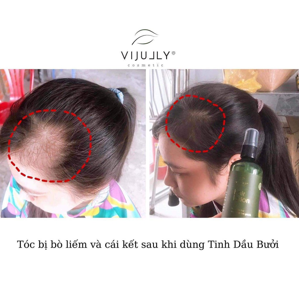 COMBO DẦU GỘI BƯỞI VIJULLY [CHÍNH HÃNG] (Gội+xả+tinh dầu) | BigBuy360 - bigbuy360.vn