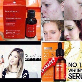 SERUM C21.5 OST Advanced- THÂM- MỤN