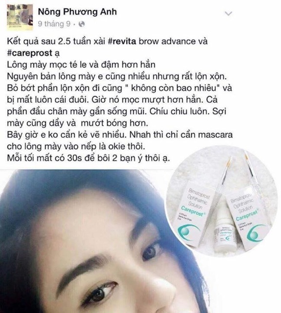 DƯỠNG DÀI MI CAREPROST ẤN ĐỘ - CHÍNH HÃNG | BigBuy360 - bigbuy360.vn