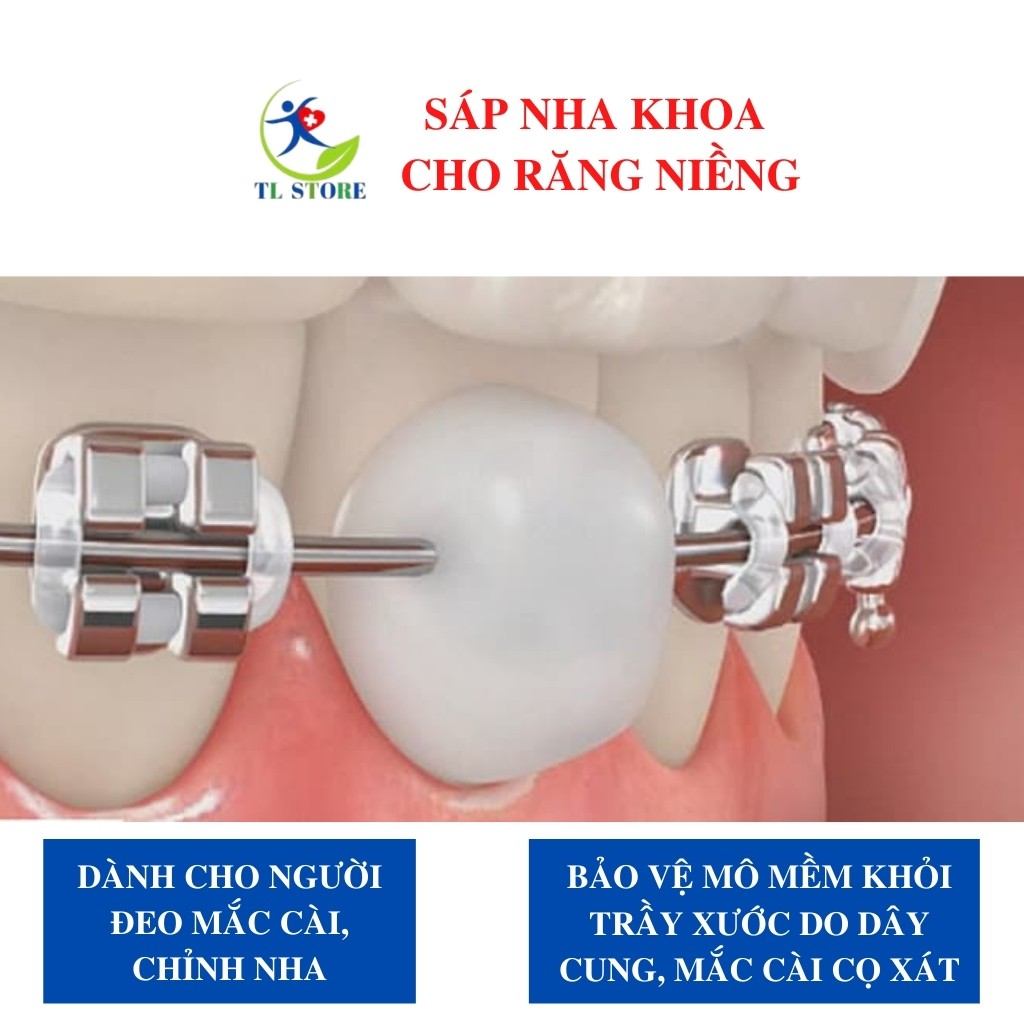 Sáp nha khoa dành cho người niềng răng chính hãng Di ya