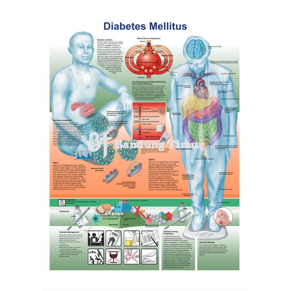 Poster Treo Tường Trang Trí In Hình Mellitus Diabetes