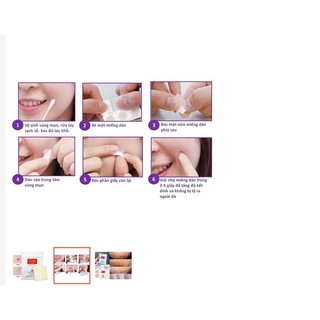 Miếng dán mụn Cosrx Acne Pimple Master Patch