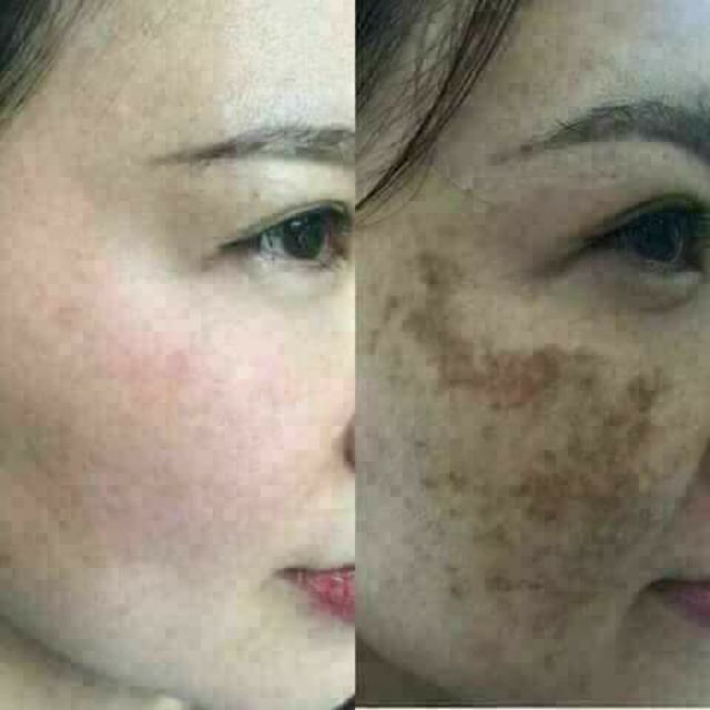 Kem kissing thai đặc chị nám dưỡng trắng chính hãng | BigBuy360 - bigbuy360.vn