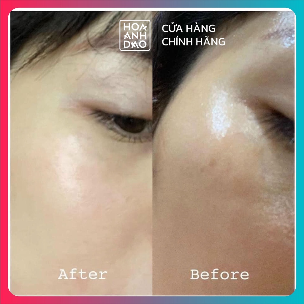 Kem dưỡng phục hồi da nhạy cảm Mesoestetic Melan Recovery 50ml
