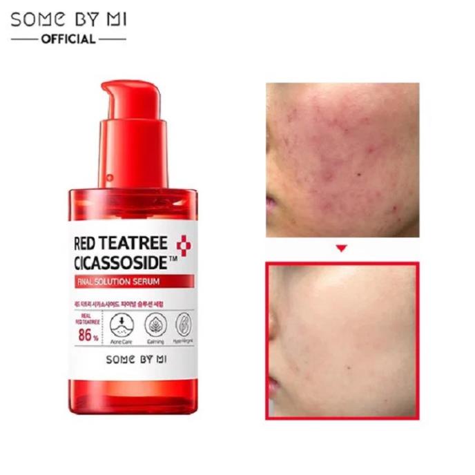 Serum Some By Mi Red Tea Tree Cicassoside Final Solution Serum 50ml cho da mụn và da nhạy cảm | BigBuy360 - bigbuy360.vn