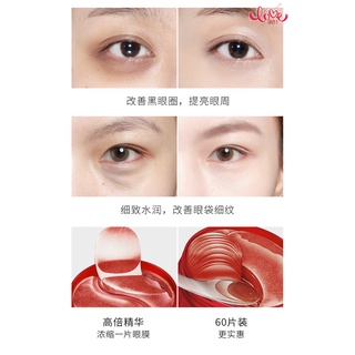 Mặt Nạ Mắt Collagen Ruby Dưỡng Ẩm Làm Dịu Da Mắt