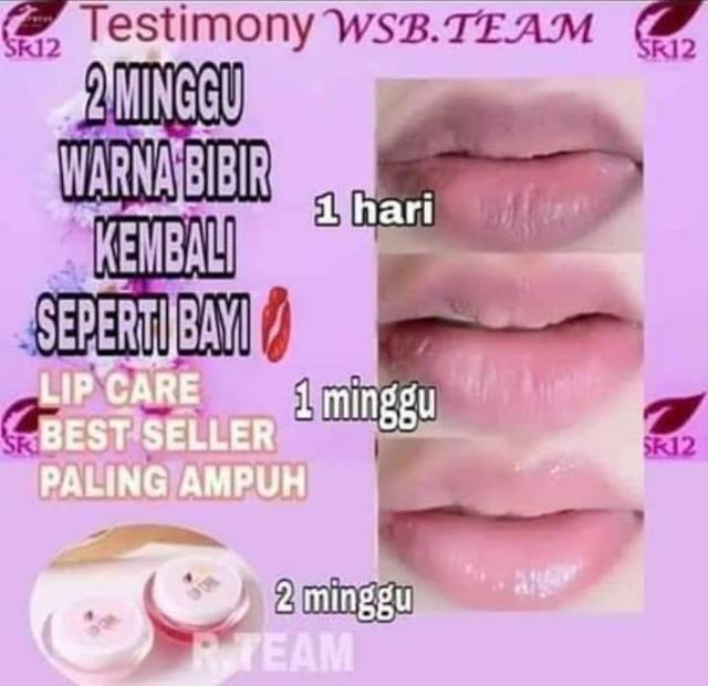 (hàng Mới Về) Son Dưỡng Môi Chăm Sóc Đôi Môi Sr12 | BigBuy360 - bigbuy360.vn