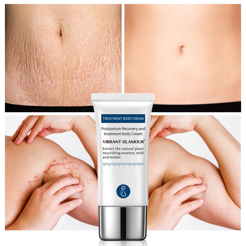 Kem Hỗ Trợ Giảm Sẹo Sau Khi Sinh VIBRANT GLAMOUR Làm Trắng Và Săn Chắc Mịn Mượt Chống Lão Hóa 30g | BigBuy360 - bigbuy360.vn