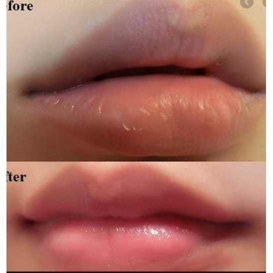 Tẩy da chết môi hủ Beauty Treats Lip Scrubs | BigBuy360 - bigbuy360.vn