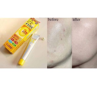 serum vitamin C #Melano CC Rohto