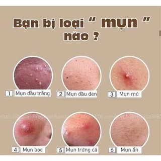 Kem Mụn Spa Ace