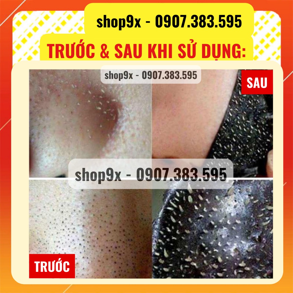 Mặt Nạ Hút Mụn Than Tre - Trắng Da Sạch Mụn