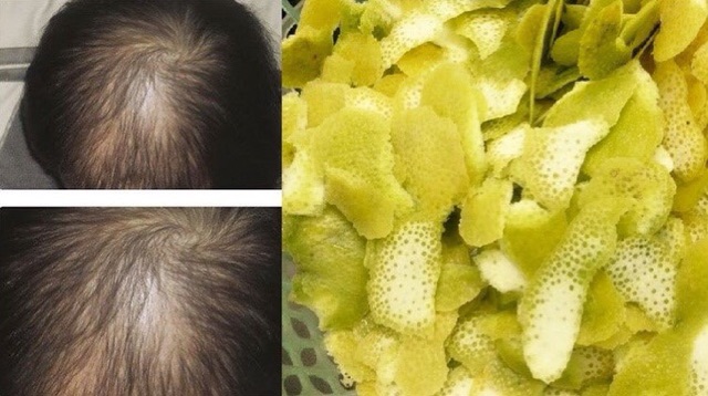 Combo Tinh dầu bưởi,dầu gội,dầu xả dừa Ngân Bình | BigBuy360 - bigbuy360.vn