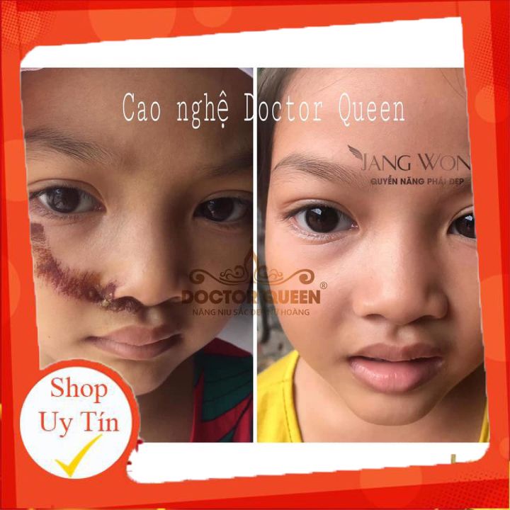 CAO NGHỆ DOCTORQUEEN 🔥𝐍𝐄𝐖🔥