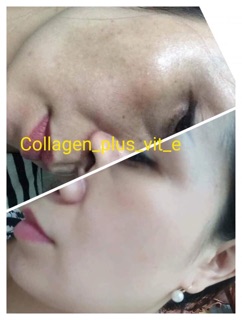 Kem collagen plus vit E