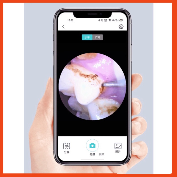 GIÁ CHỈ HÔM NAY Máy cạo vôi răng Xiaomi Sunuo T12 Pro - Máy lấy cao răng Sunuo T11 GIÁ CHỈ HÔM NAY