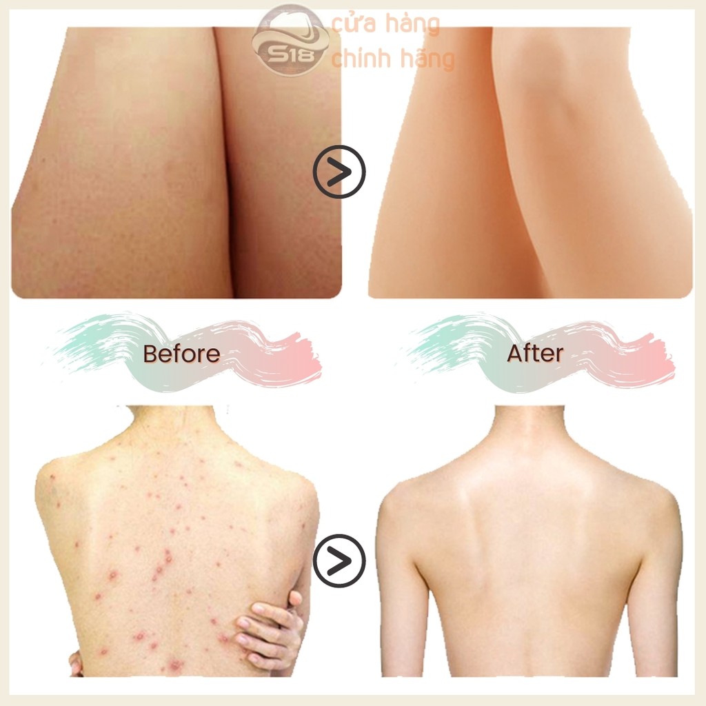 tẩy da chết body - tẩy tế bào chết môi - mặt - tay - da đầu - toàn thân, cà phê nguyên chất - handmade - S18 coffee | BigBuy360 - bigbuy360.vn