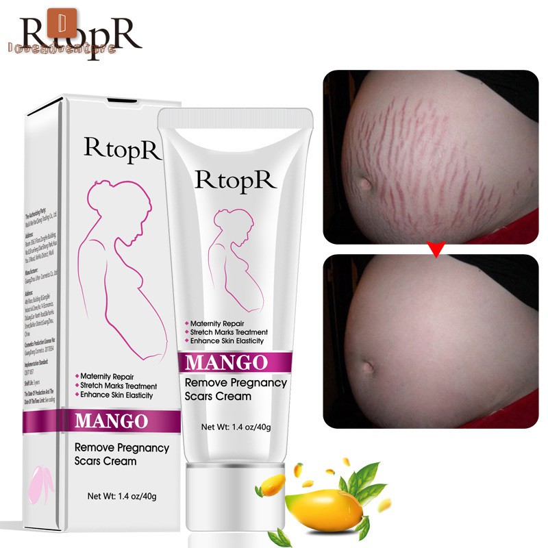 Kem hỗ trợ phục hồi da bị rạn và sẹo đa năng 40g RtopR thích hợp cho phụ nữ mang thai