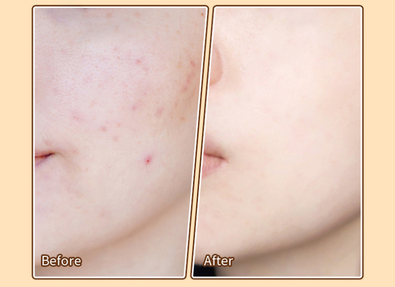 (Hàng Mới Về) Kem Che Khuyết Điểm Quầng Thâm Bọng Mắt Thương Hiệu Kiss Beauty | BigBuy360 - bigbuy360.vn