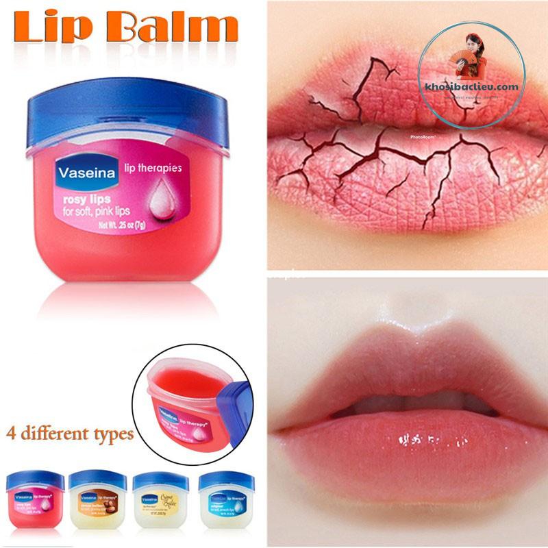 Son Dưỡng Môi Vaseline 7g Chính Hãng Cao Cấp