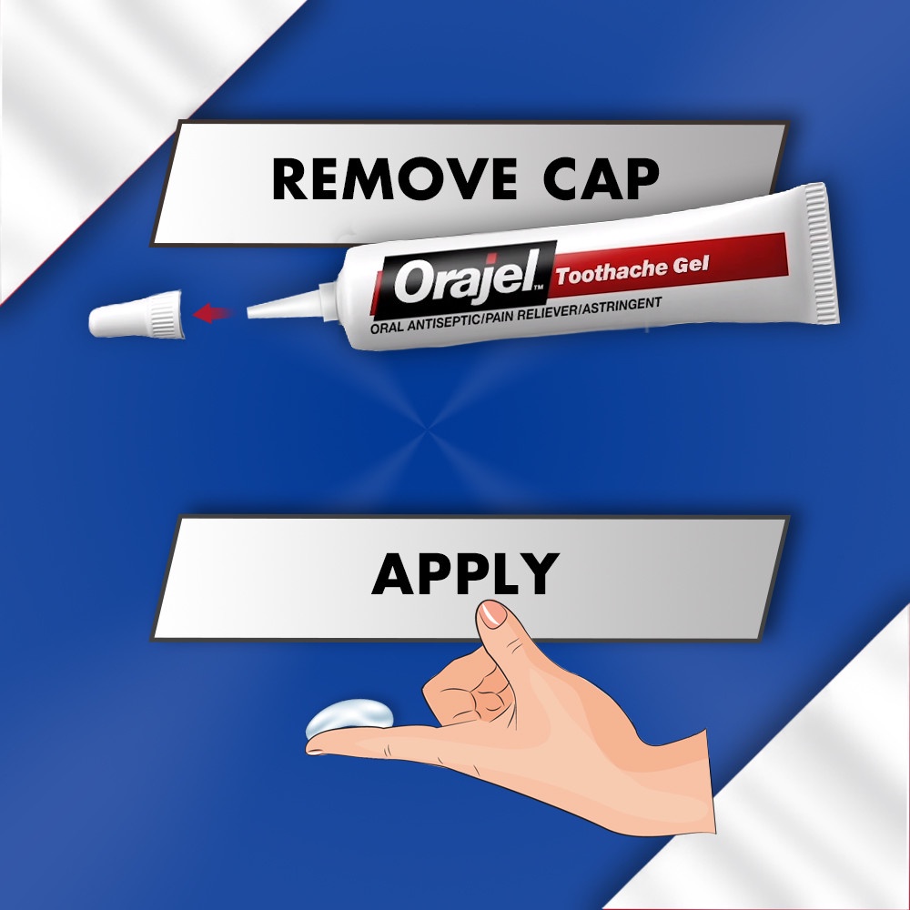 [DATE 2/2023] Orajel 3X Medicated For All Mouth Sores Gel 11,9G