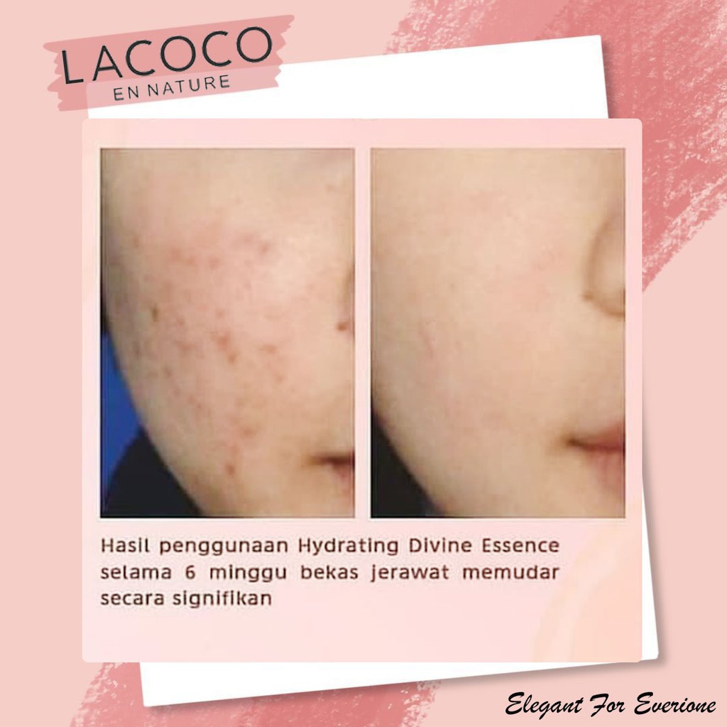 Tinh Chất Dưỡng Ẩm Làm Sáng Da Chống Lão Hóa Lacoco | BigBuy360 - bigbuy360.vn