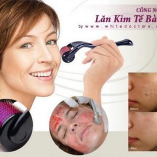 Cây lăn đầu kim 0.5mm trị sẹo, mụn, rỗ cám