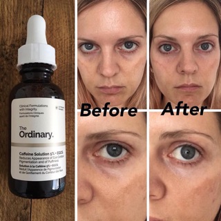 Săn Sale - The ordinary Caffeine Solution 5% + EGCG