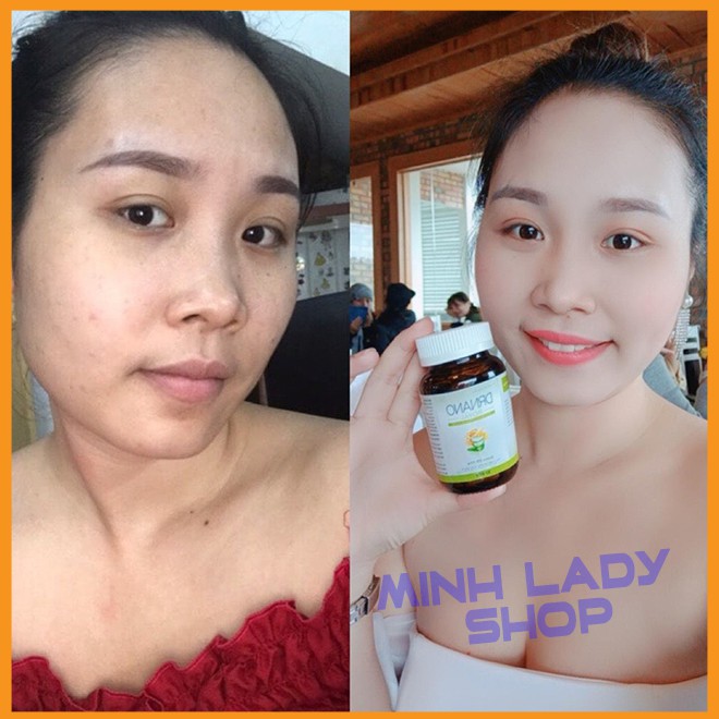 Viên Uống Trắng Da Dian Beauty, [Mua 1 Tặng 2] ,Mua 2 Giảm thêm 59K, FreeShip, Trắng toàn thân, mờ nám | BigBuy360 - bigbuy360.vn
