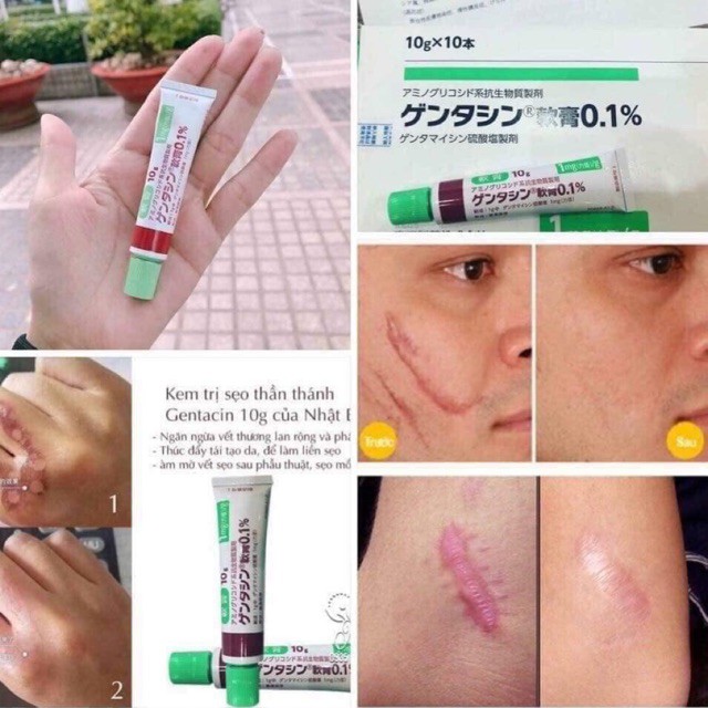 GEL TRỊ SẸO GENTACIN 10G NHẬT BẢN