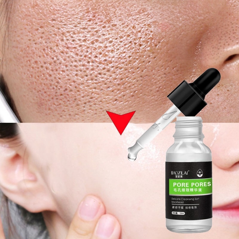 Tinh Chất Vàng 24k Lactobionic Acid Thu Nhỏ Lỗ Chân Lông Giảm Mụn Đầu Đen Dưỡng Ẩm Chống Lão Hóa 10