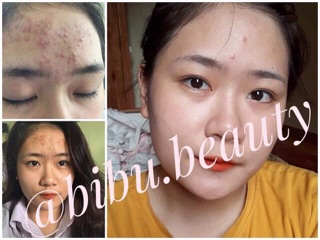 Serum biểu bì Vaurora