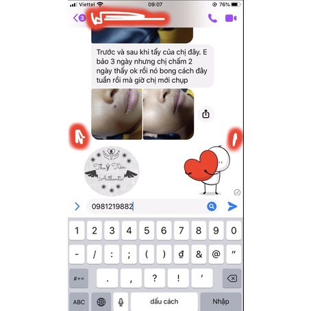 Gel tẩy mụn ruồi,mụn cóc, mụn cơm,tàn nhang | BigBuy360 - bigbuy360.vn