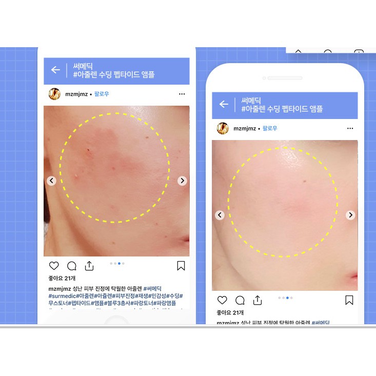 MBC Dòng dưỡng ẩm và làm dịu da NOG    SurMedic Azulene Smoothing Peptide cho da dầu