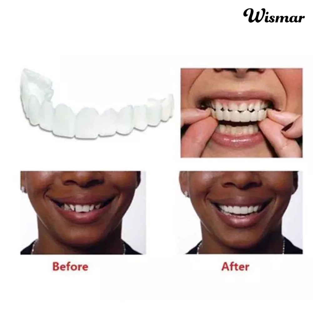 Bộ 2 hàm răng giả trên và dưới tiện lợi