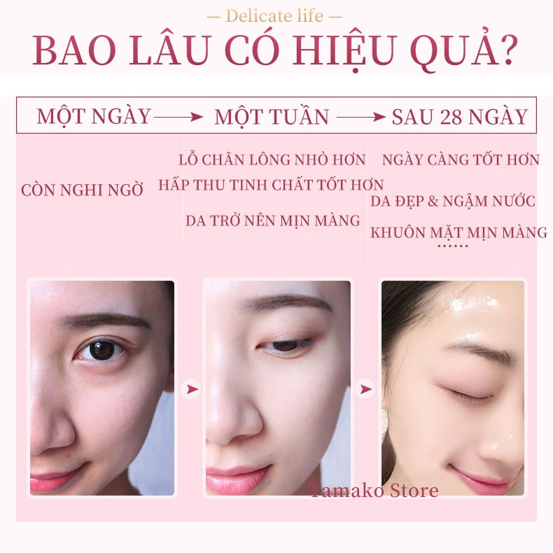 Máy điện di chăm sóc da đẩy tinh chất serum lotion toner nước hoa hồng ILIFT ánh sáng sinh học trẻ da (mã IF-1108) | BigBuy360 - bigbuy360.vn