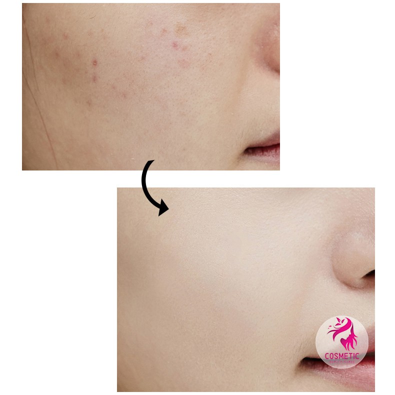 Phấn Phủ ORANOT Foundation Kiềm Dầu Che Khuyết Điểm P10 | BigBuy360 - bigbuy360.vn