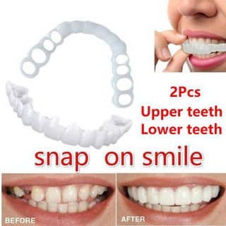 Dụng cụ niềng răng tại nhà snapon smile - nẹp răng tại nhà