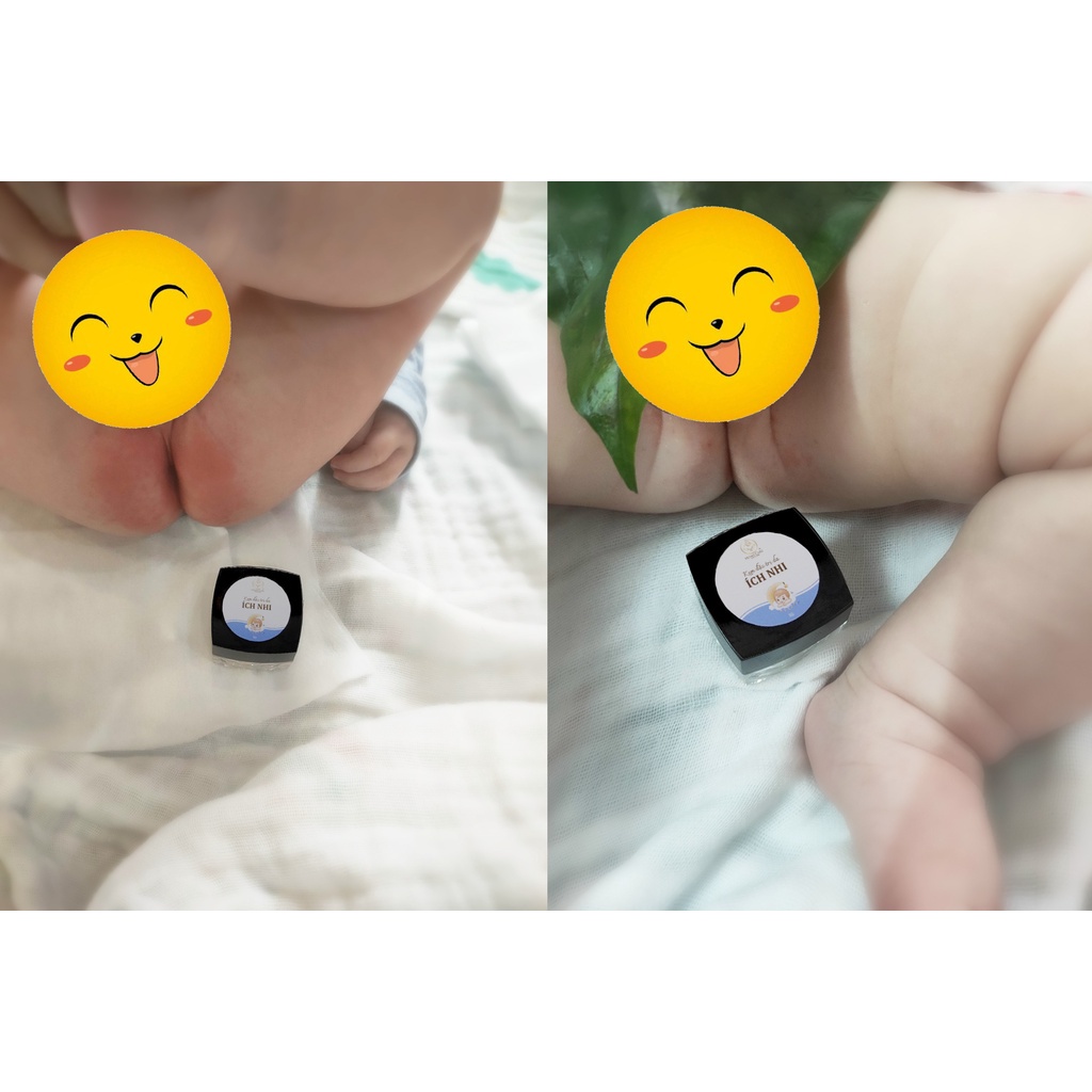 Kem hăm từ thiên nhiên đánh bay hăm ngứa cho bé Home Care - hộp 5g