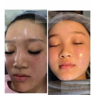 Căng bóng da MULGWANG X5