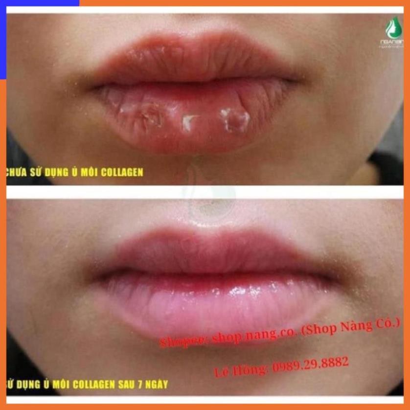 SON Ủ MÔI SHI - MỀN MÔI - DƯỠNG MÔI - HỒNG MÔI - TRỊ THÂM MÔI V V V | BigBuy360 - bigbuy360.vn